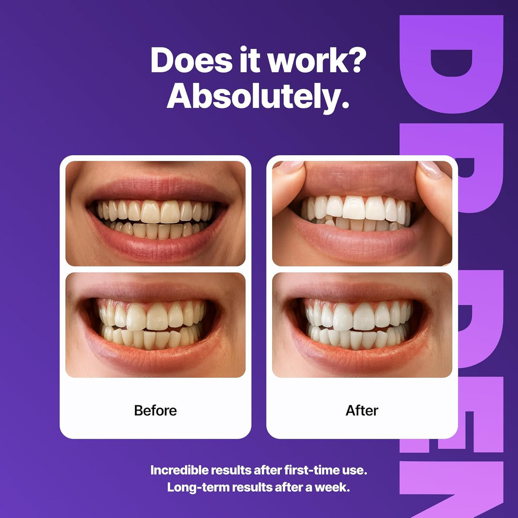 Dr. Dent™️ Teeth Whitening Strips | Buy 1 Get 1 Free